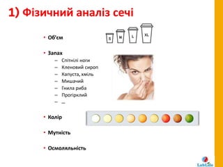 Автоматичний аналіз сечі: мінімум участі - максимум можливостей