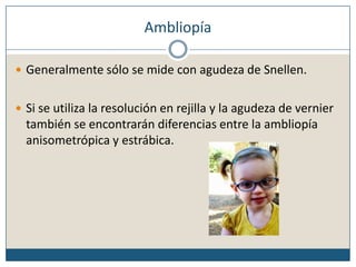 AmbliopíaGeneralmente sólo se mide con agudeza de Snellen.Si se utiliza la resolución en rejilla y la agudeza de vernier también se encontrarán diferencias entre la ambliopía anisometrópica y estrábica.