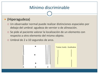 Mínimo discriminable(Hiperagudeza)Un observador normal puede realizar distinciones espaciales por debajo del umbral: agudeza de vernier o de alineación.Se pide al paciente valorar la localización de un elemento con respecto a otro elemento del mismo objeto.Umbral de 2 a 10 segundos de arco. 