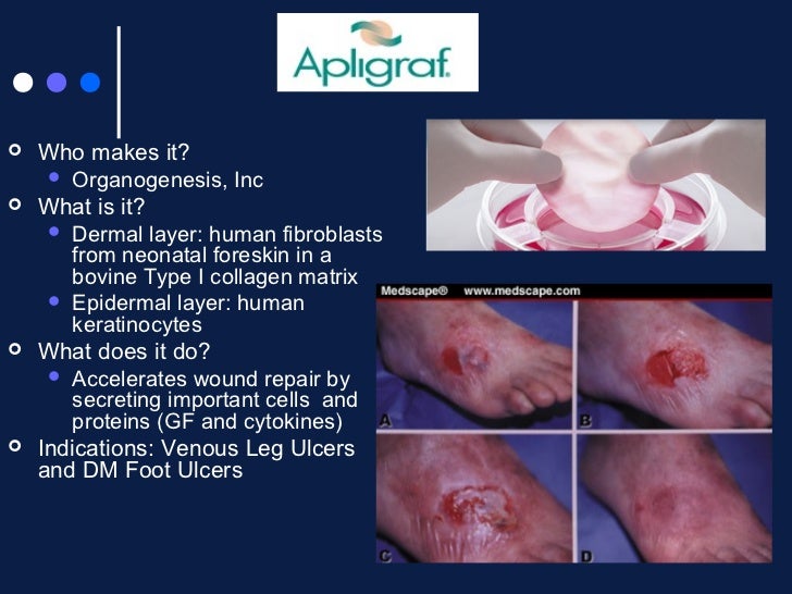 Wound Care From then to now