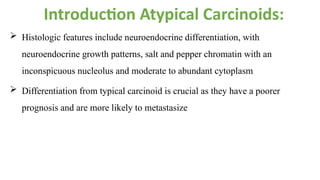 Comprehensive Overview of Pulmonary Carcinoid Tumors: Diagnosis and ...