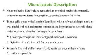 Comprehensive Overview of Pulmonary Carcinoid Tumors: Diagnosis and ...