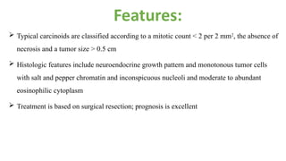 Comprehensive Overview of Pulmonary Carcinoid Tumors: Diagnosis and ...