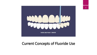 Current Concepts of Fluoride Use
Seminar1
7
 