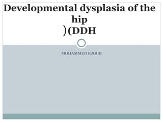 Developmental dysplasia of the
hip
( (DDH
MOHAMMED RJOUB

 