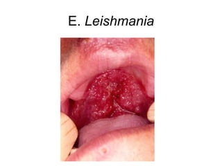 E. Leishmania
 