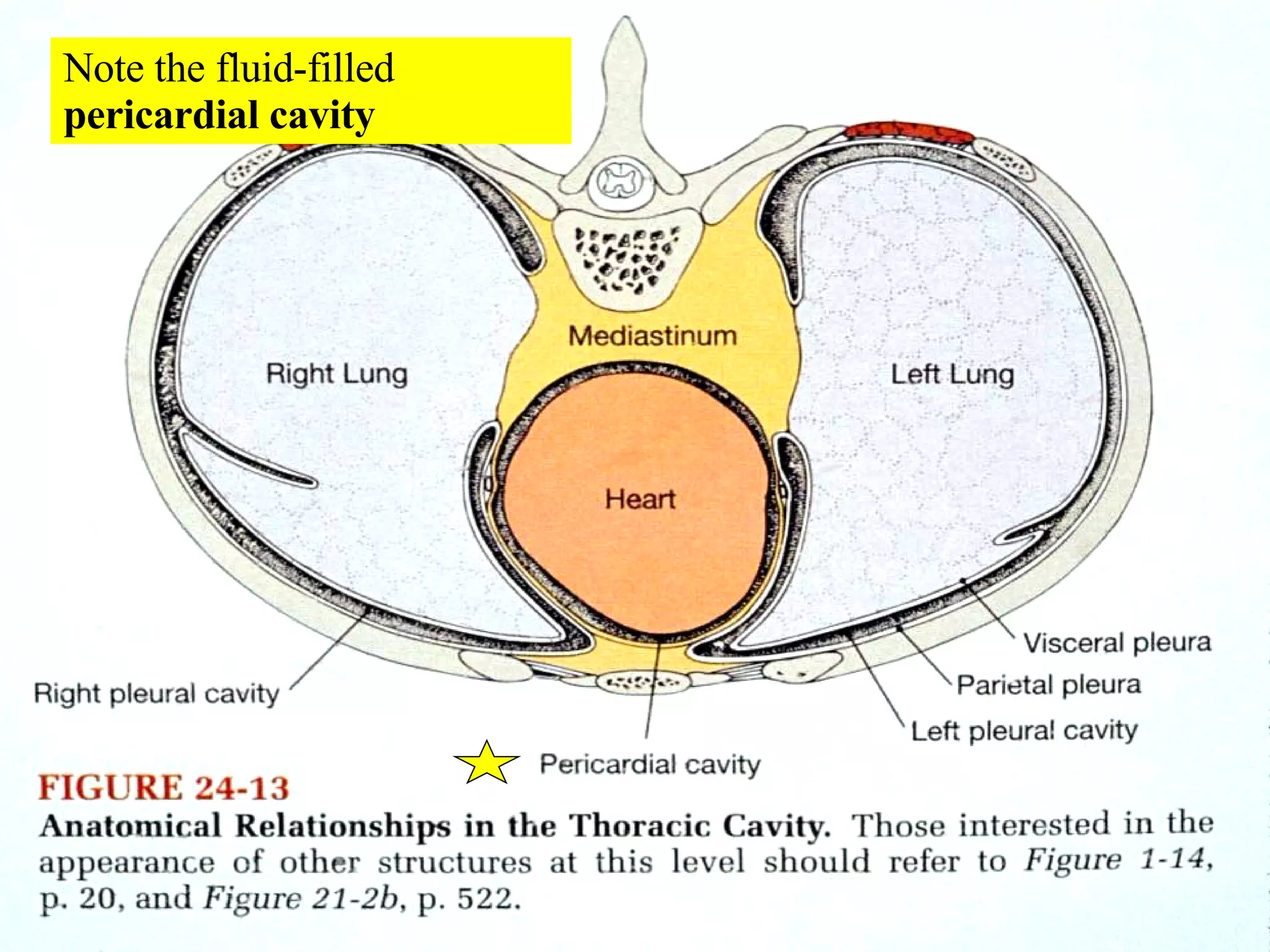 Note the fluid-filled  pericardial cavity 