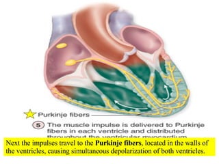 Next the impulses travel to the  Purkinje fibers , located in the walls of the ventricles, causing simultaneous depolarization of both ventricles. 