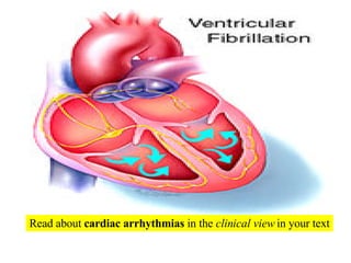 Read about  cardiac arrhythmias  in the  clinical view  in your text 