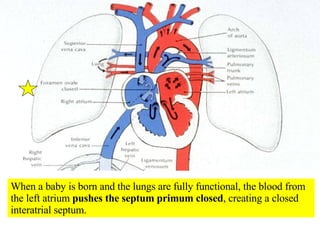 When a baby is born and the lungs are fully functional, the blood from the left atrium  pushes the septum primum closed , creating a closed interatrial septum.  