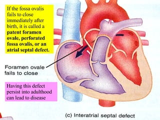 If the fossa ovalis fails to close immediately after birth, it is called a  patent foramen ovale, perforated fossa ovalis, or an atrial septal defect. Having this defect persist into adulthood can lead to disease 