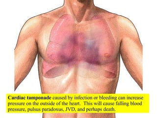 Cardiac tamponade  caused by infection or bleeding can increase pressure on the outside of the heart.  This will cause falling blood pressure, pulsus paradoxus, JVD, and perhaps death. 