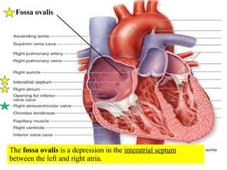 The  fossa ovalis  is a depression in the  interatrial septum  between the left and right atria. Fossa ovalis 
