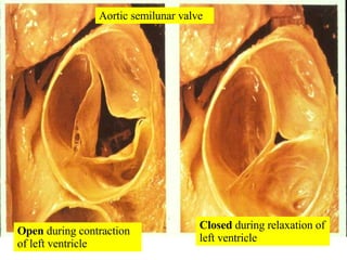 Aortic semilunar valve Open  during contraction of left ventricle Closed  during relaxation of left ventricle 