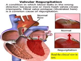 Read the  clinical view  in text. 