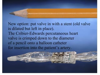 New option: put valve in with a stent (old valve is dilated but left in place). The Cribier-Edwards percutaneous heart  valve is crimped down to the diameter  of a pencil onto a balloon catheter  for insertion into the patient’s artery.  