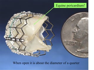 When open it is about the diameter of a quarter Equine pericardium! 