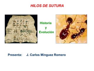 HILOS DE SUTURA
Historia
y
Evolución
Presenta: J. Carlos Mínguez Romero
 