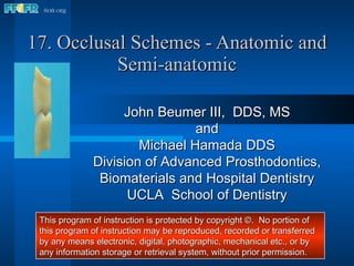 17. Occlusal Schemes - Anatomic and Semi-anatomic John Beumer III,  DDS, MS and Michael Hamada DDS Division of Advanced Prosthodontics, Biomaterials and Hospital Dentistry UCLA  School of Dentistry This program of instruction is protected by copyright ©.  No portion of this program of instruction may be reproduced, recorded or transferred by any means electronic, digital, photographic, mechanical etc., or by any information storage or retrieval system, without prior permission. 