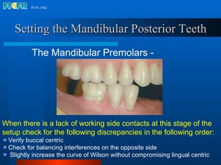 17.occlusal schemes anatomic and semiamatomic occlusion | PPT