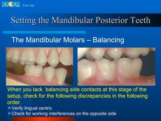 17.occlusal schemes anatomic and semiamatomic occlusion | PPT