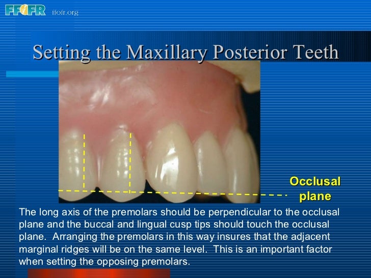 17.occlusal schemes anatomic and semiamatomic occlusion