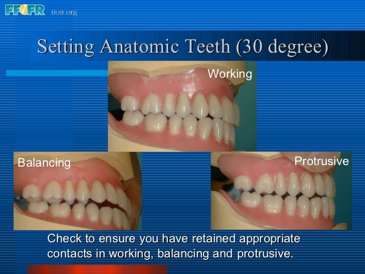 17.occlusal schemes anatomic and semiamatomic occlusion