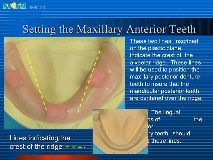 17.occlusal schemes anatomic and semiamatomic occlusion