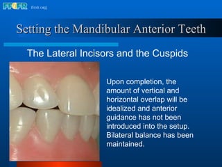 17.occlusal schemes anatomic and semiamatomic occlusion | PPT