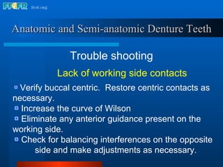 17.occlusal schemes anatomic and semiamatomic occlusion | PPT