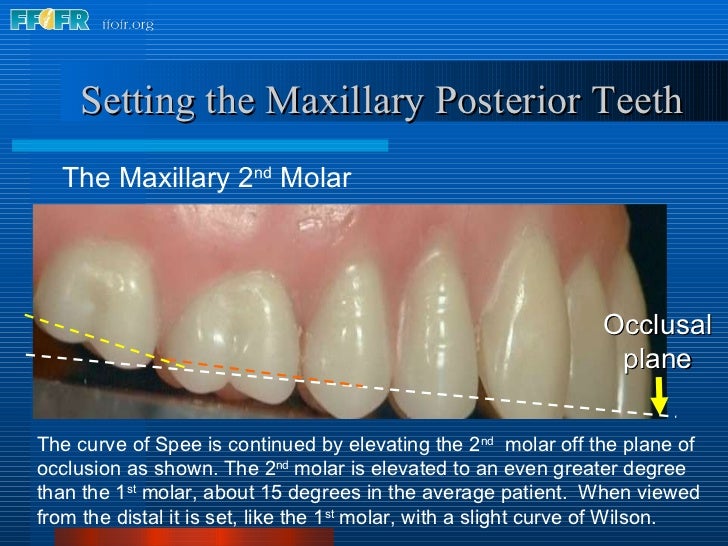 17.occlusal schemes anatomic and semiamatomic occlusion