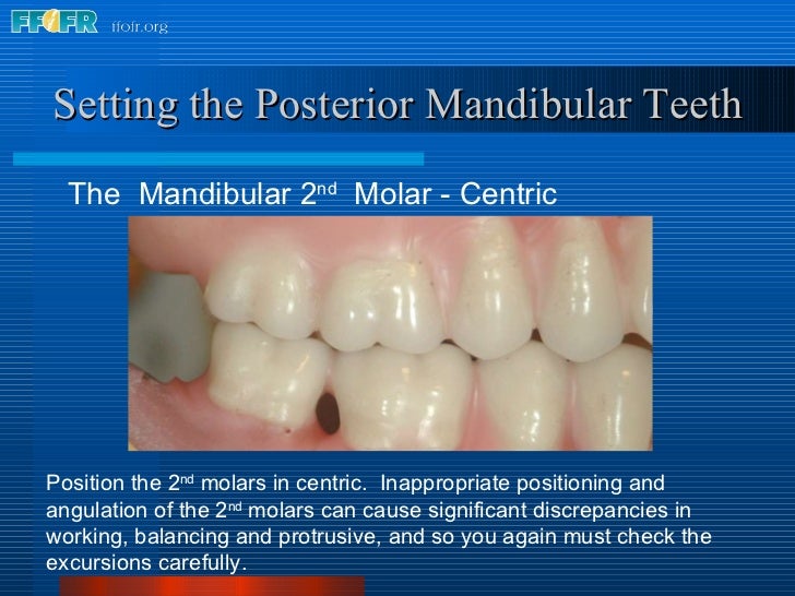 17.occlusal schemes anatomic and semiamatomic occlusion