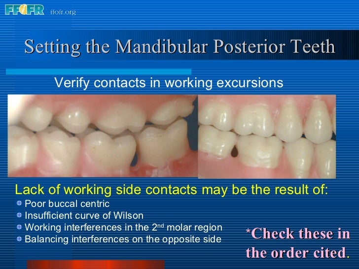17.occlusal schemes anatomic and semiamatomic occlusion
