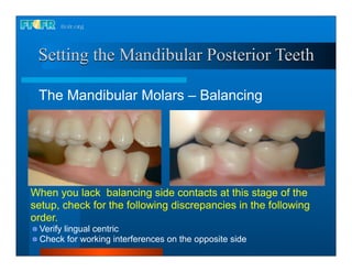 17.occlusal schemes anatomic and semiamatomic occlusion | PDF