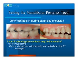 17.occlusal schemes anatomic and semiamatomic occlusion | PDF