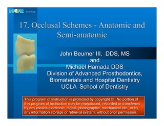 17. Occlusal Schemes - Anatomic and
           Semi-anatomic

                   John Beumer III, DDS, MS
                               and
                      Michael Hamada DDS
              Division of Advanced Prosthodontics,
               Biomaterials and Hospital Dentistry
                    UCLA School of Dentistry

 This program of instruction is protected by copyright ©. No portion of
 this program of instruction may be reproduced, recorded or transferred
 by any means electronic, digital, photographic, mechanical etc., or by
 any information storage or retrieval system, without prior permission.
 