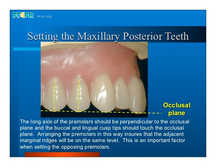 17.occlusal schemes anatomic and semiamatomic occlusion
