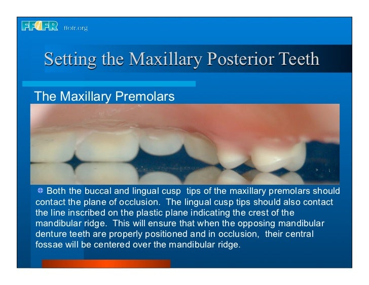 17.occlusal schemes anatomic and semiamatomic occlusion
