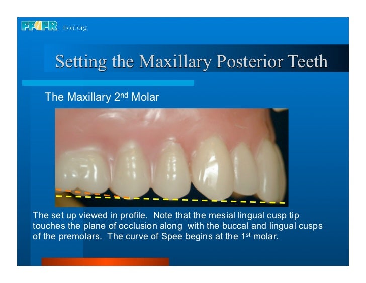 17.occlusal schemes anatomic and semiamatomic occlusion