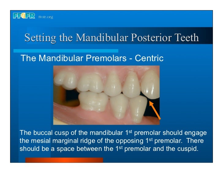 17.occlusal schemes anatomic and semiamatomic occlusion