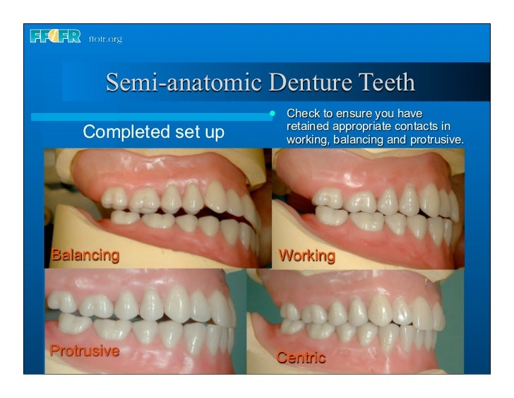 17.occlusal schemes anatomic and semiamatomic occlusion