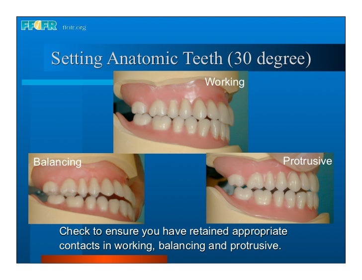 17.occlusal schemes anatomic and semiamatomic occlusion