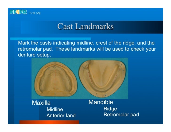 17.occlusal schemes anatomic and semiamatomic occlusion
