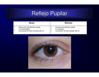 Reflejo Pupilar
                    Reflejo Pupilar
                Miosis                                    Midriasis

Disminución del diámetro pupilar            Aumento del diámetro pupilar
S. Parasimpático                            S. Simpático
Contracción M. lisos circulares del iris.   Contracción M. lisos radiales del iris
 