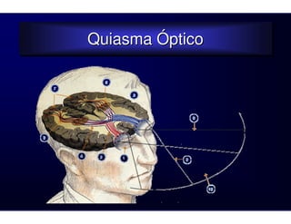 Quiasma Óptico
Quiasma Óptico
 