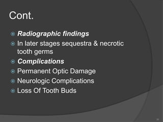 Cont.
 Radiographic findings
 In later stages sequestra & necrotic
tooth germs
 Complications
 Permanent Optic Damage
 Neurologic Complications
 Loss Of Tooth Buds
30
 