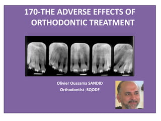 170-THE ADVERSE EFFECTS OF
ORTHODONTIC TREATMENT
Olivier Oussama SANDID
Orthodontist -SQODF
 
