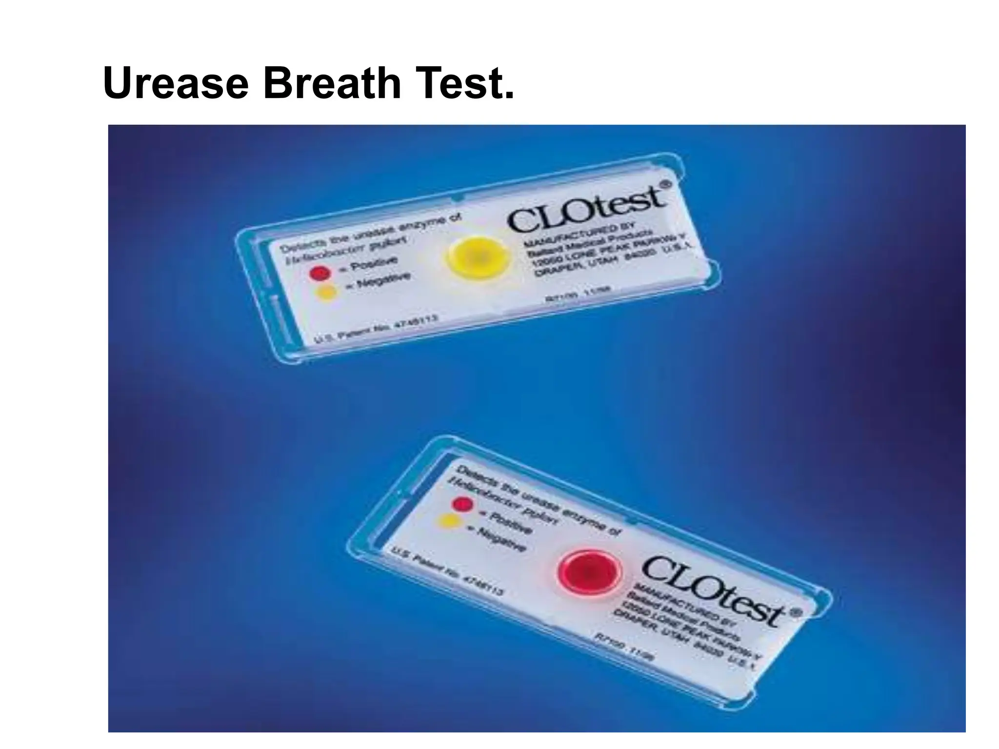 Urease Breath Test.
 