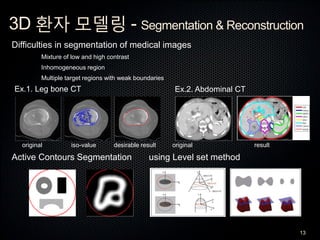 3D 환자 모델링 - Segmentation & Reconstruction
13
Difficulties in segmentation of medical images
Mixture of low and high contra...