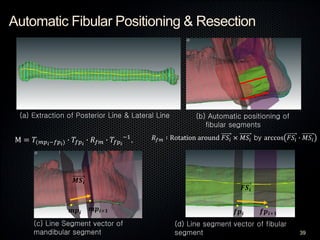 Automatic Fibular Positioning & Resection
39
(a) Extraction of Posterior Line & Lateral Line (b) Automatic positioning of
...